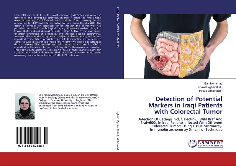 Detection of Potential Markers in Iraqi Patients with Colorectal Tumor: Detection Of Cathepsin-d, Galectin-3, Wild Braf And Brafv600e In Iraqi ... Immunohistochemistry (tma- Ihc) Technique - Image 1