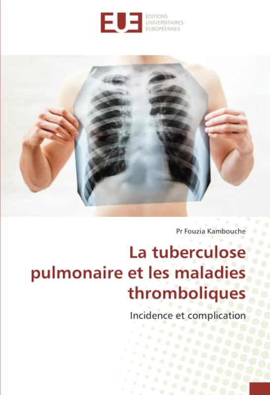 La tuberculose pulmonaire et les maladies thromboliques: Incidence et complication