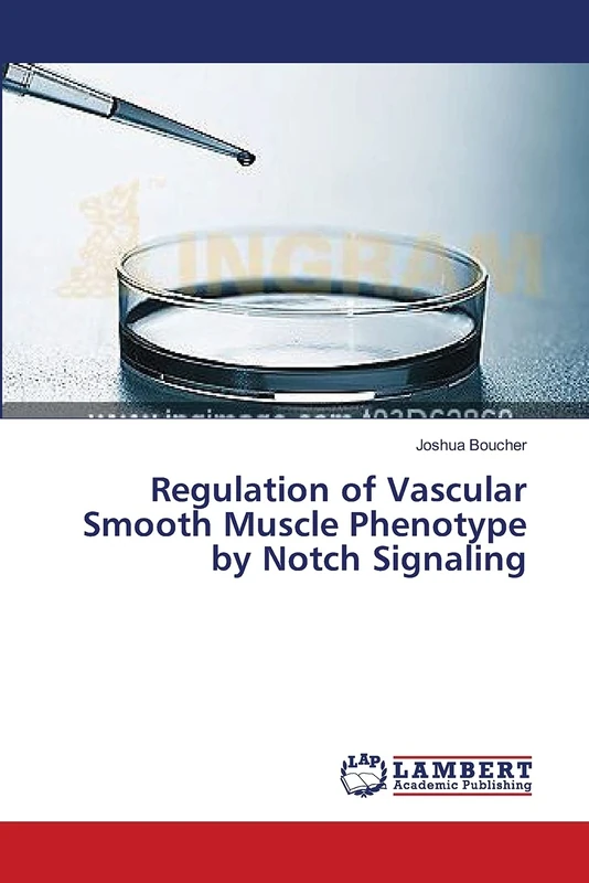 Regulation of Vascular Smooth Muscle Phenotype by Notch Signaling - Image 1