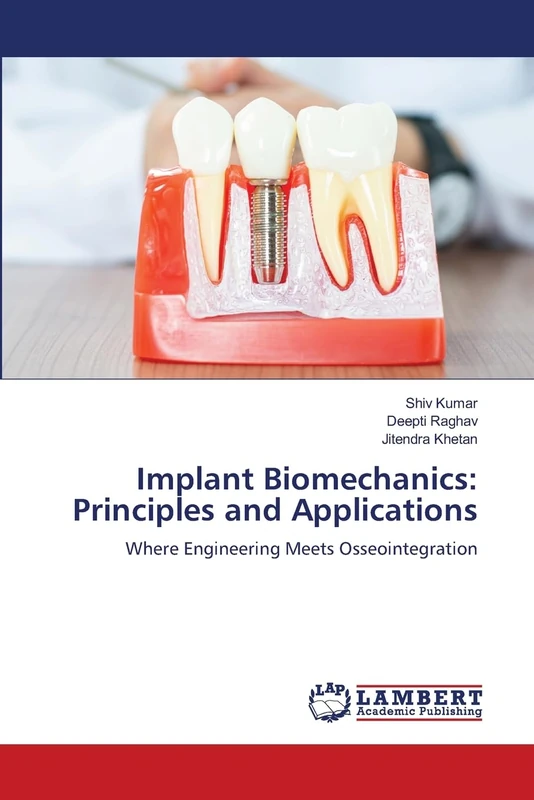 Implant Biomechanics: Principles and Applications: Where Engineering Meets Osseointegration