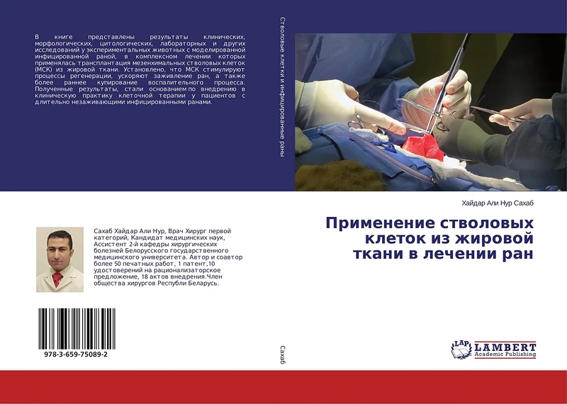 Применение стволовых клеток из жировой ткани в лечении ран