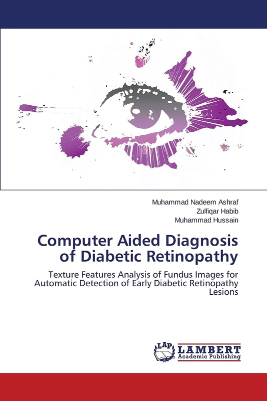 Computer Aided Diagnosis of Diabetic Retinopathy: Texture Features Analysis of Fundus Images for Automatic Detection of Early Diabetic Retinopathy Lesions