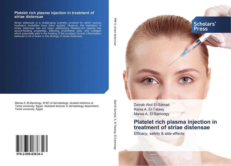 Platelet rich plasma injection in treatment of striae distensae: Efficacy, safety & side effects - Image 1
