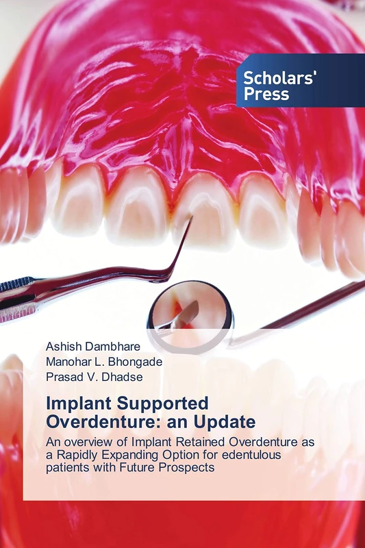 Implant Supported Overdenture: an Update: An overview of Implant Retained Overdenture as a Rapidly Expanding Option for edentulous patients with Future Prospects