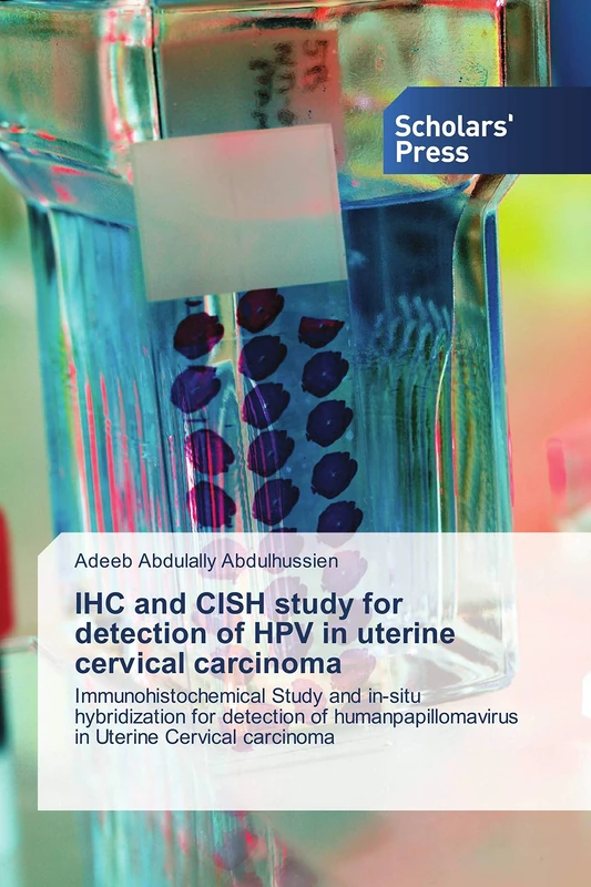 IHC and CISH study for detection of HPV in uterine cervical carcinoma: Immunohistochemical Study and in-situ hybridization for detection of humanpapillomavirus in Uterine Cervical carcinoma