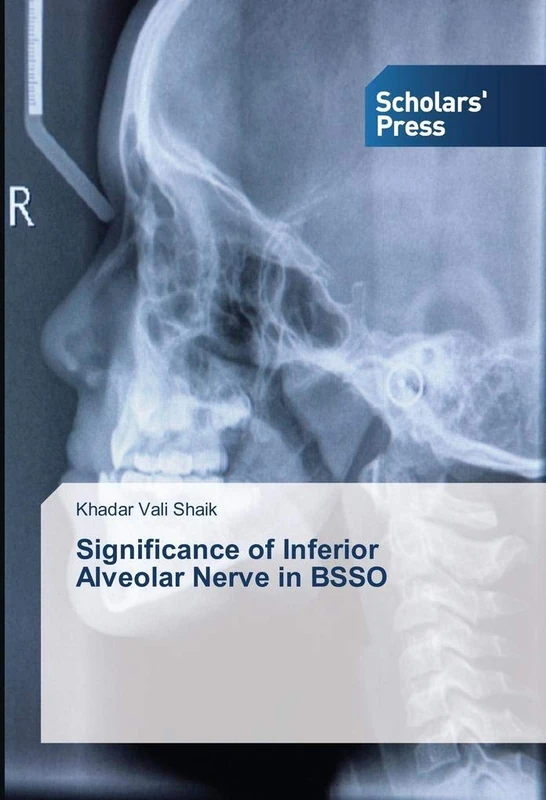 Significance of Inferior Alveolar Nerve in BSSO - Image 1