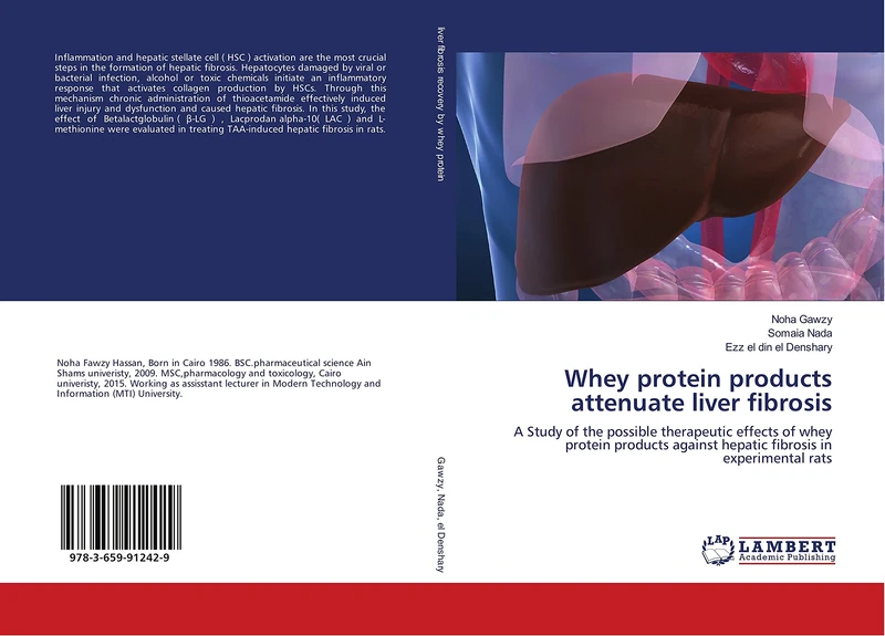 Whey protein products attenuate liver fibrosis: A Study of the possible therapeutic effects of whey protein products against hepatic fibrosis in experimental rats