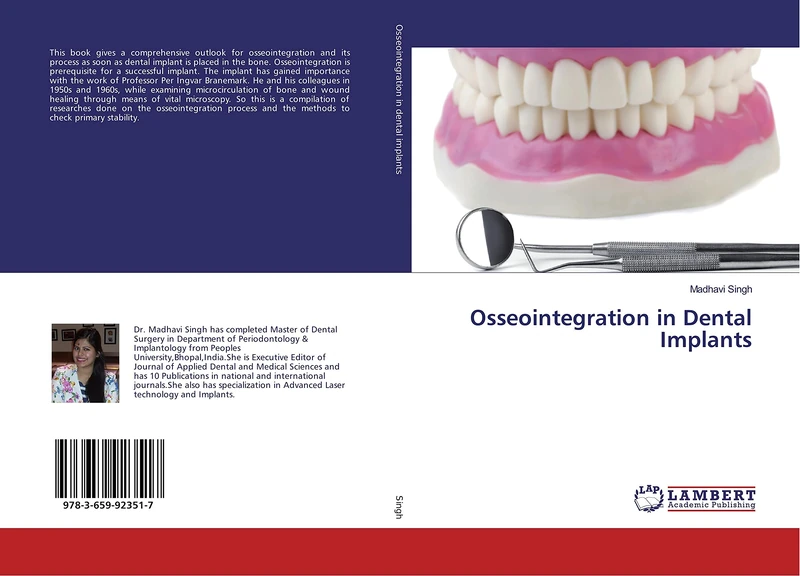 Osseointegration in Dental Implants - Image 1