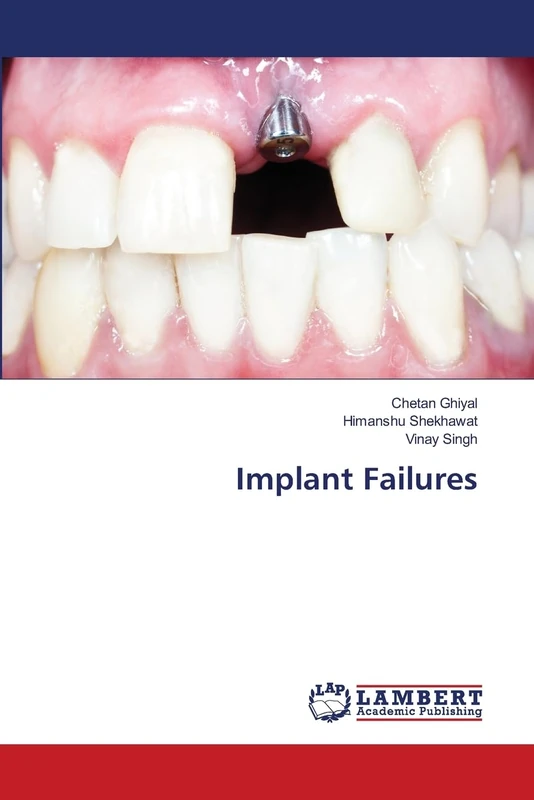 Implant Failures