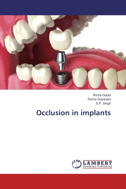 Occlusion in implants - Image 1