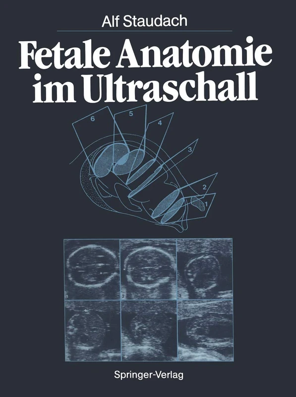 Fetale Anatomie im Ultraschall - Image 1