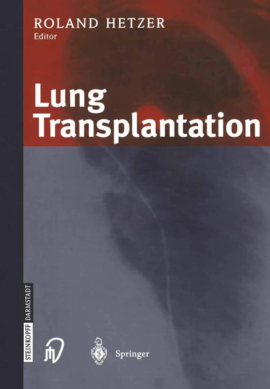Lung Transplantation - Image 1