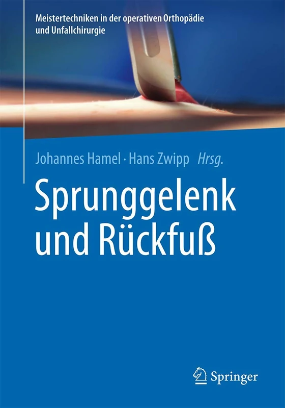 Sprunggelenk und Rückfuß (Meistertechniken in der operativen Orthopädie und Unfallchirurgie)