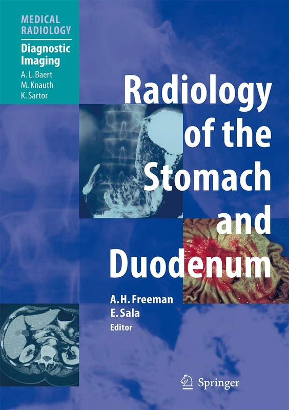 Radiology of the Stomach and Duodenum (Medical Radiology)