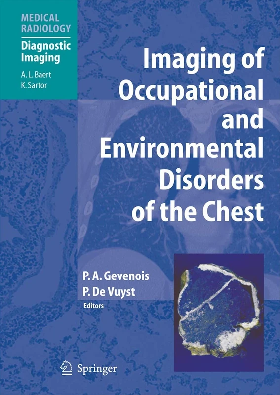 Imaging of Occupational and Environmental Disorders of the Chest (Medical Radiology)