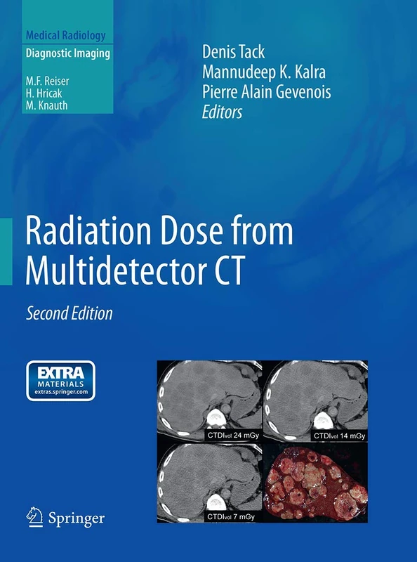 Radiation Dose from Multidetector CT (Medical Radiology)