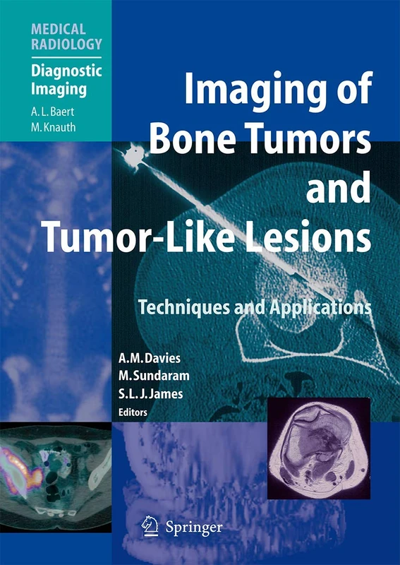 Springer Imaging of Bone Tumors and Tumor-Like Lesions Textbook - Image 1