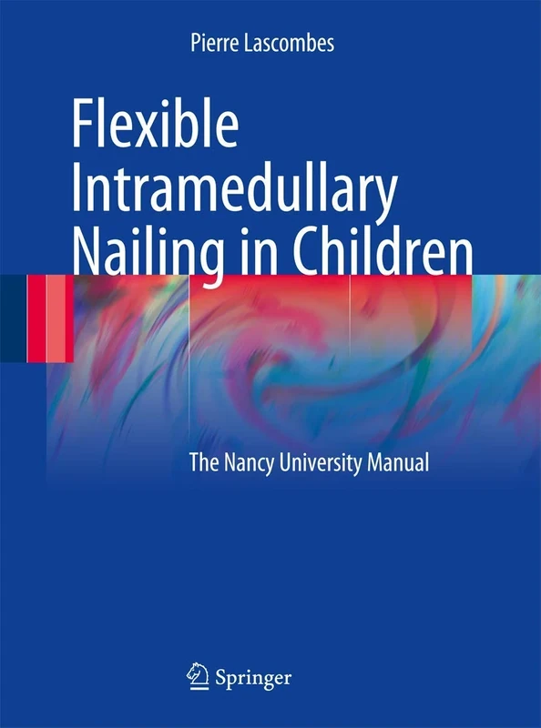 Flexible Intramedullary Nailing in Children: The Nancy University Manual