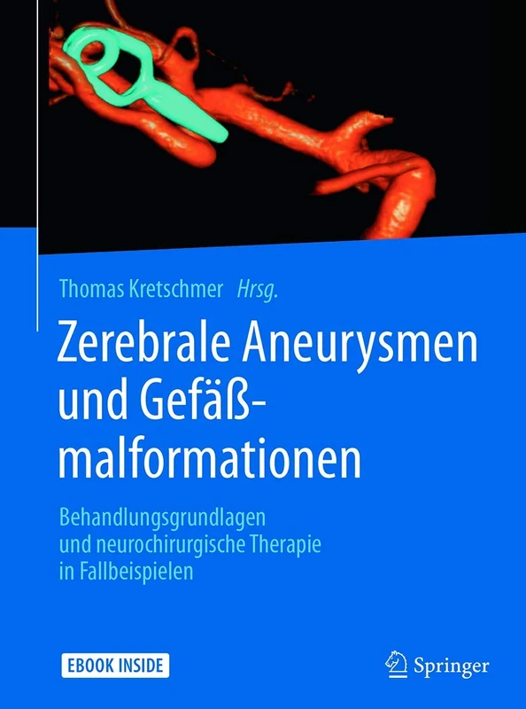 Zerebrale Aneurysmen und Gefäßmalformationen: Behandlungsgrundlagen und neurochirurgische Therapie in Fallbeispielen