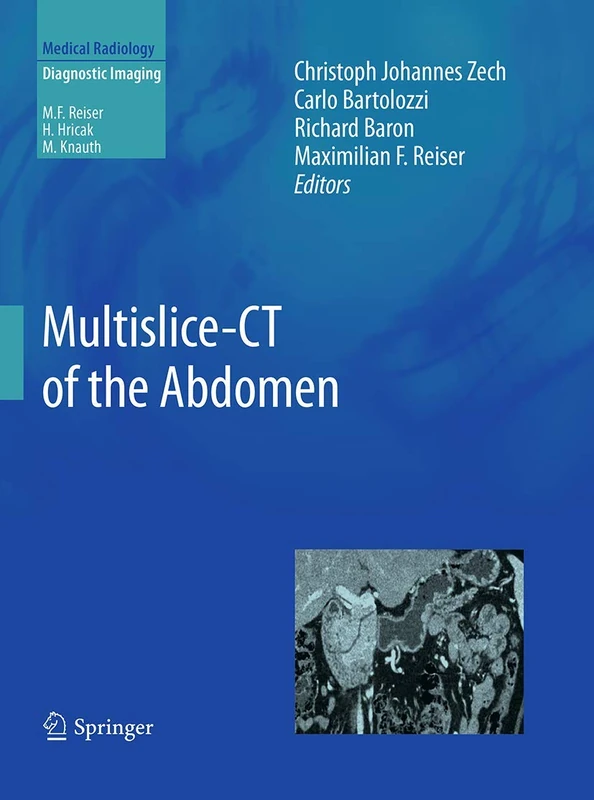 Multislice-CT of the Abdomen (Medical Radiology)