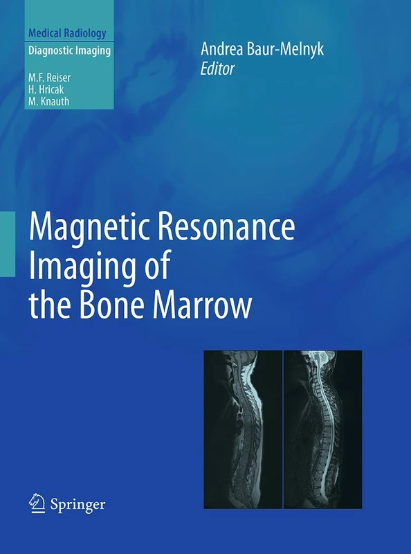 Magnetic Resonance Imaging of the Bone Marrow (Diagnostic Imaging)