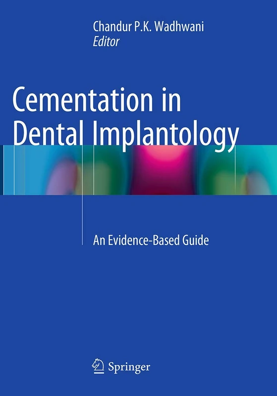 Cementation in Dental Implantology: An Evidence-Based Guide