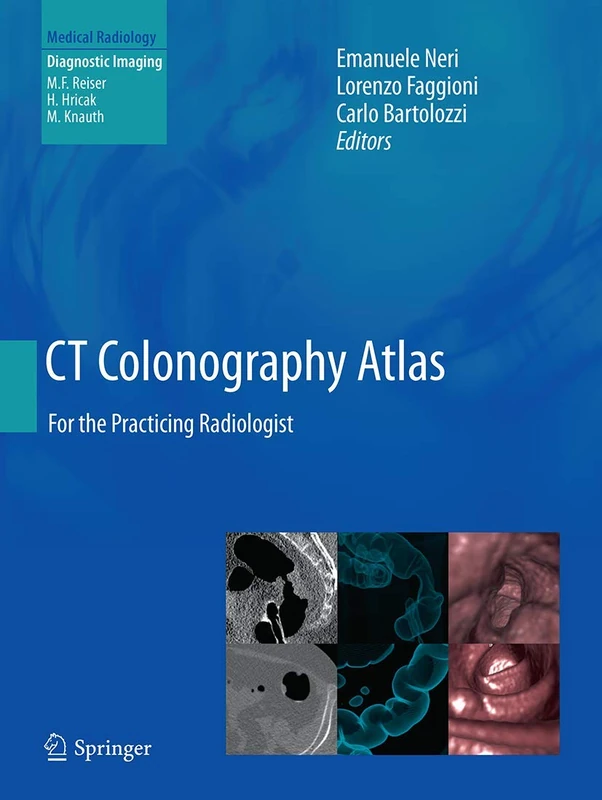 CT Colonography Atlas: For the Practicing Radiologist (Medical Radiology)