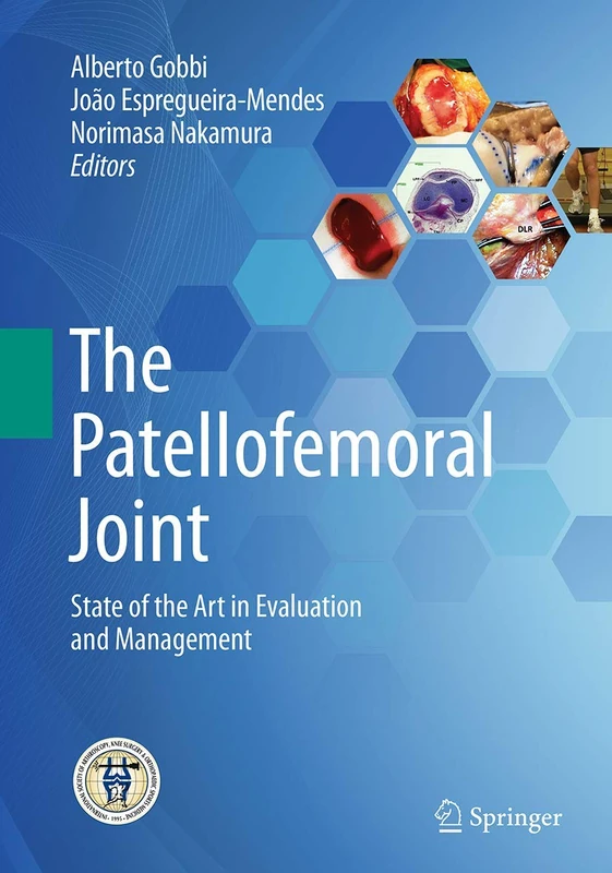 The Patellofemoral Joint: State of the Art in Evaluation and Management