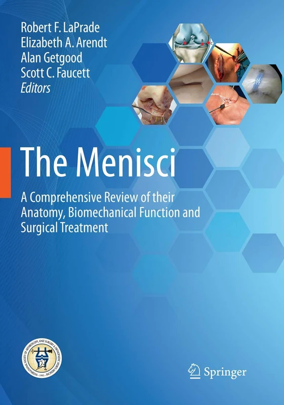 The Menisci: A Comprehensive Review of their Anatomy, Biomechanical Function and Surgical Treatment