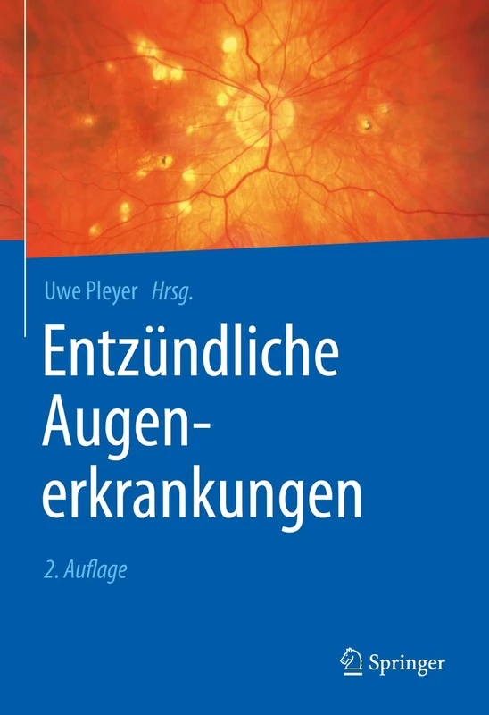 Springer - Entzundliche Augenerkrankungen - Medical Textbook
