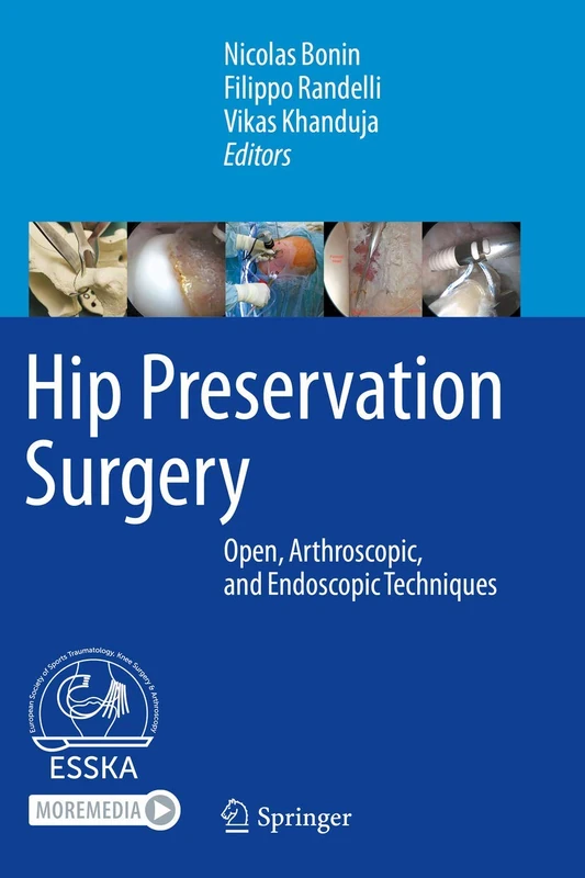 Springer Hip Preservation Surgery: Open and Arthroscopic Book