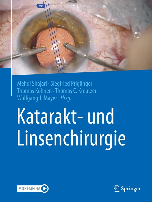 Katarakt- und Linsenchirurgie: In Der Augenheilkunde