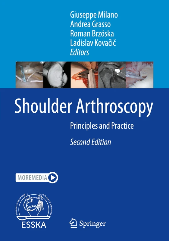 Springer - Shoulder Arthroscopy: Principles and Practice Book