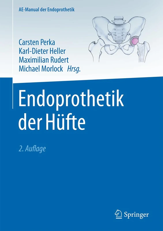 Springer - Endoprothetik der Hufte (AE-Manual der Endoprothetik) - Image 1