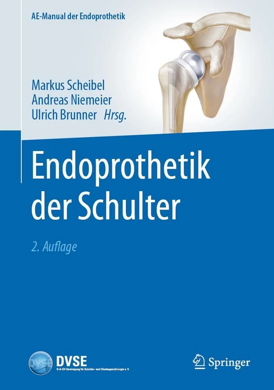 Endoprothetik der Schulter (AE-Manual der Endoprothetik)