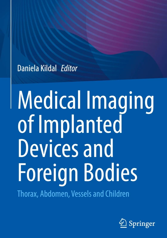 Medical Imaging of Implanted Devices and Foreign Bodies: Thorax, Abdomen, Vessels and Children