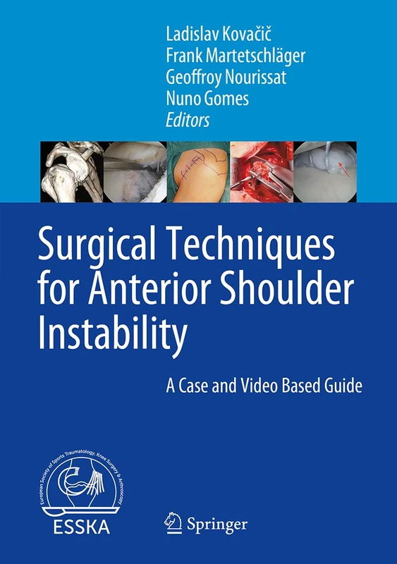 Surgical Techniques for Anterior Shoulder Instability: A Case and Video Based Guide