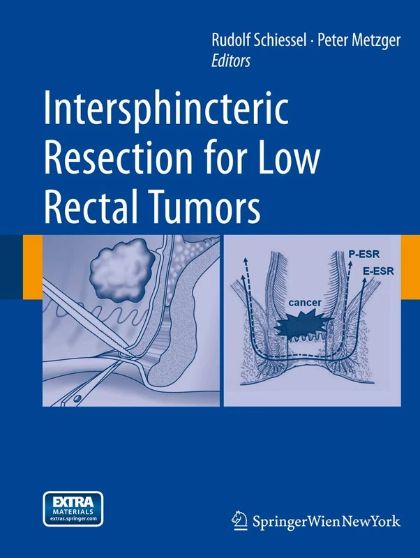 Intersphincteric Resection for Low Rectal Tumors - Springer