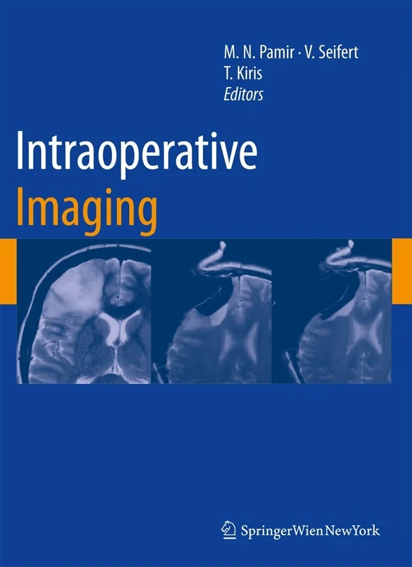 Intraoperative Imaging: 109 (Acta Neurochirurgica Supplement, 109)