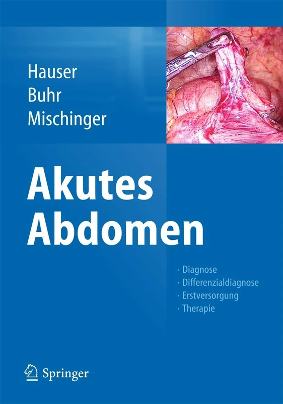 Akutes Abdomen: Diagnose - Differenzialdiagnose - Erstversorgung - Therapie