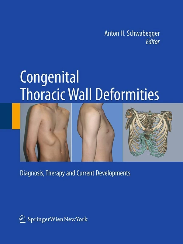 Congenital Thoracic Wall Deformities: Diagnosis, Therapy and Current Developments