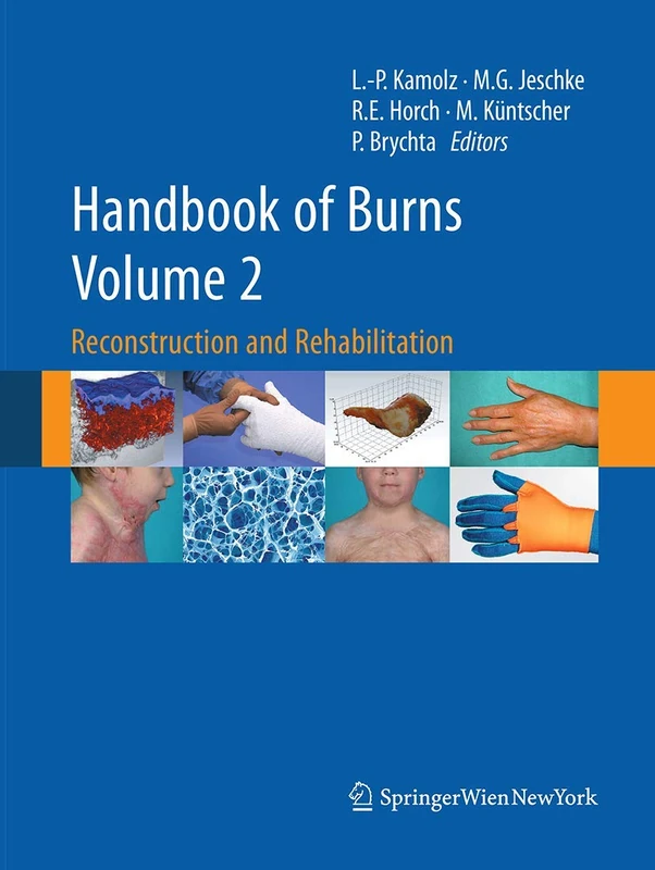 Springer Handbook of Burns Volume 2: Reconstruction and Rehab