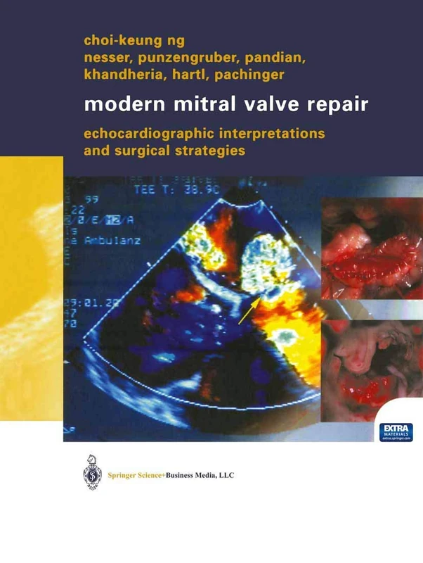 Modern Mitral Valve Repair: Echocardiographic Interpretations and Surgical Strategies