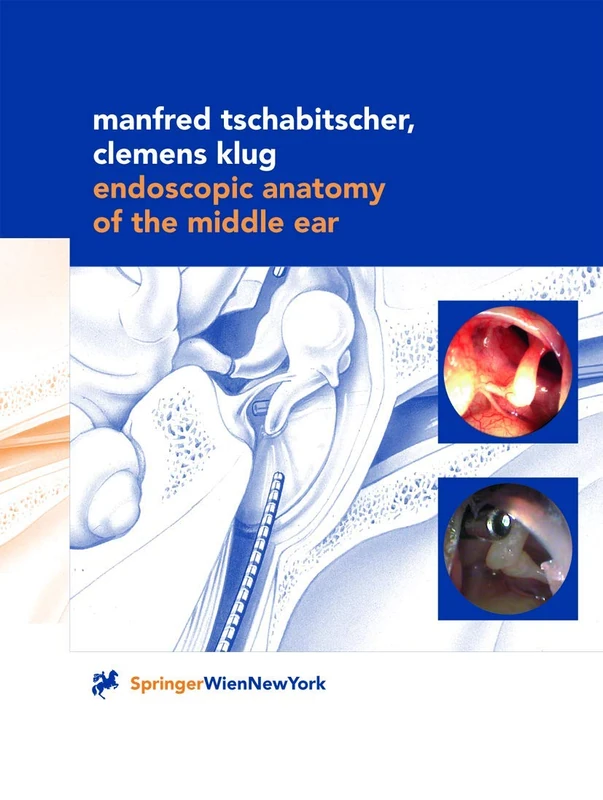 Endoscopic Anatomy of the Middle Ear - Image 1