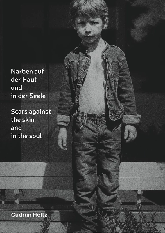 J.Lindeberg - Narben auf der Haut und in der Seele - Book - Image 1