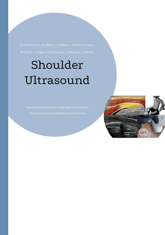 Shoulder Ultrasound: Sonoanatomy and Sonopathology Atlas of the Shoulder Including Anatomy, Radiography and Arthroscopy