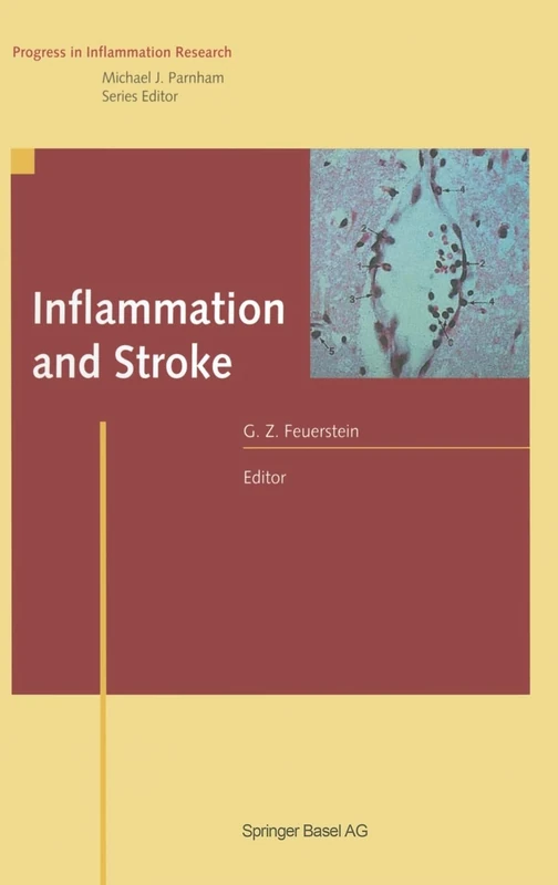 Inflammation and Stroke (Progress in Inflammation Research)