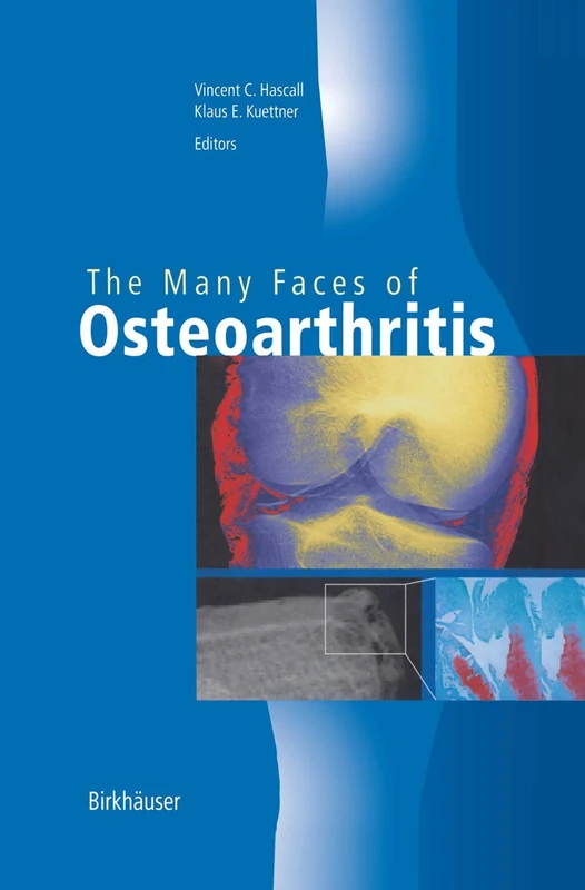 Birkhauser - The Many Faces of Osteoarthritis Book
