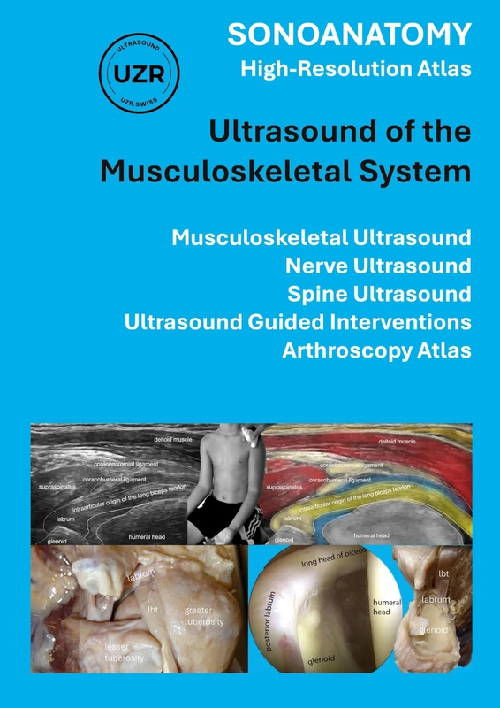 Sonoanatomy - High-Resolution Atlas - Ultrasound of the Musculoskeletal System: Musculoskeletal Ultrasound, Nerve Ultrasound, Spine Ultrasound, Ultrasound Guided Interventions, Arthroscopy Atlas