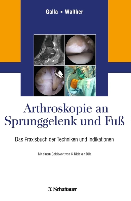 Arthroskopie an Sprunggelenk und Fuß: Das Praxisbuch der Techniken und Indikationen